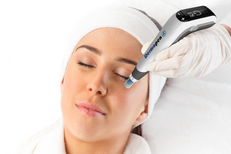 Microneedling Results – What to expect after microneedling treatment?