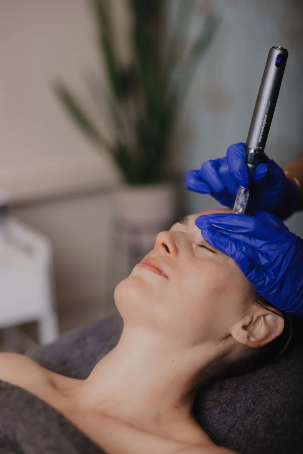 skin needling