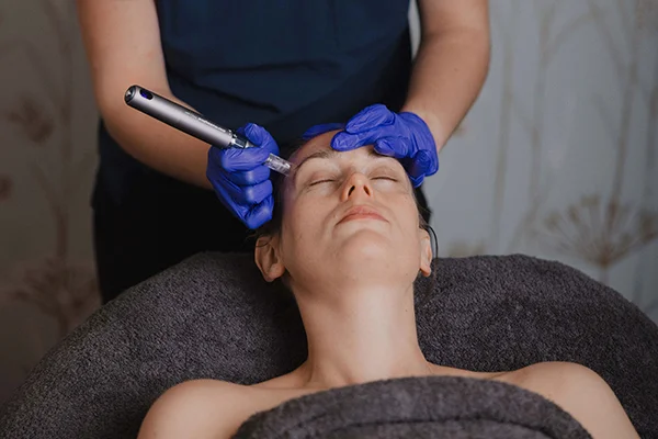 bio needling matamata